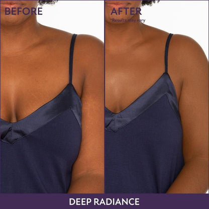 ⏳Limited Time Discount-49% Off💥Beauty Body Coverage Perfector