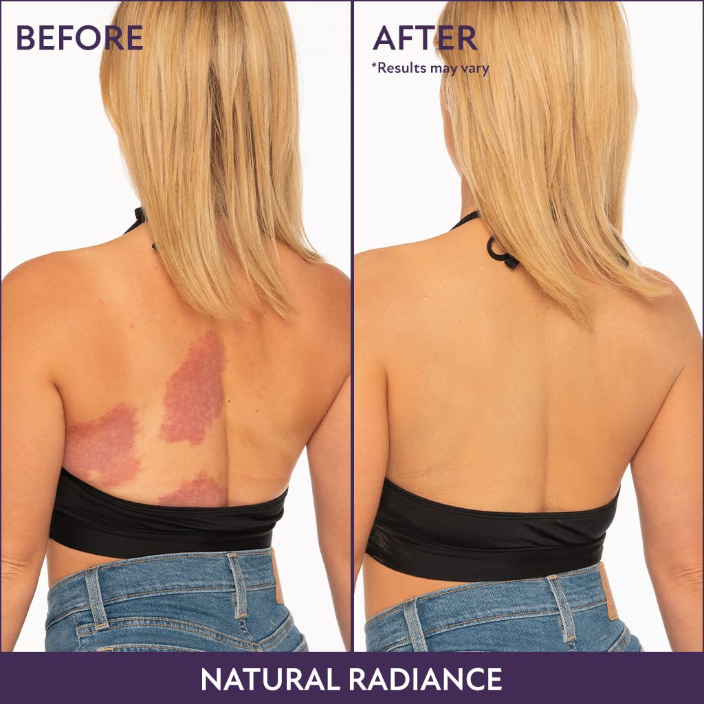⏳Limited Time Discount-49% Off💥Beauty Body Coverage Perfector