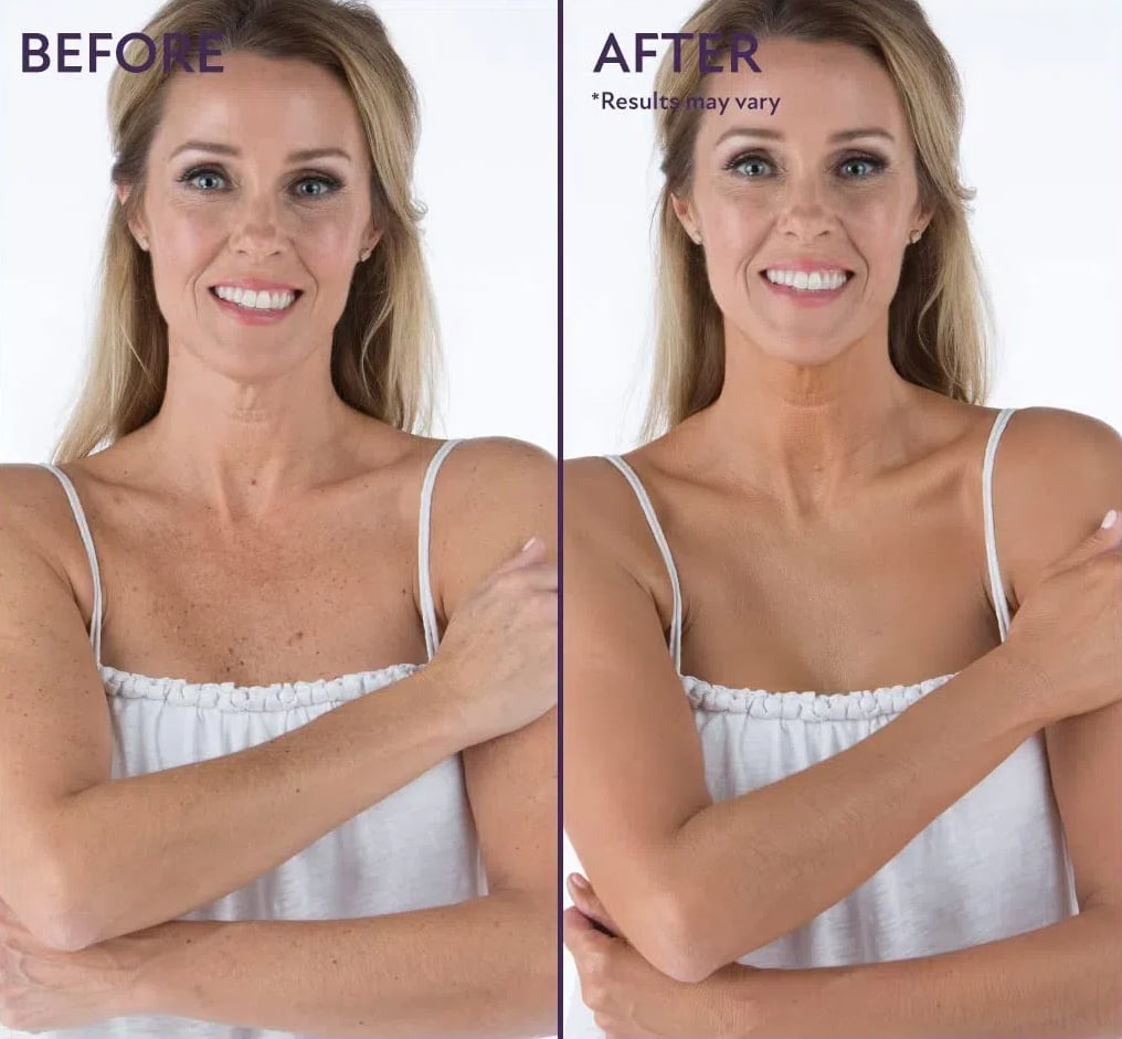 ⏳Limited Time Discount-49% Off💥Beauty Body Coverage Perfector