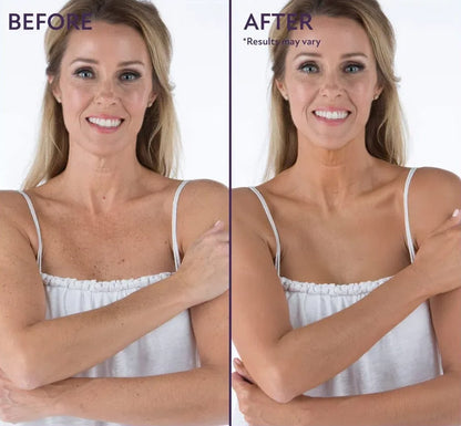 ⏳Limited Time Discount-49% Off💥Beauty Body Coverage Perfector